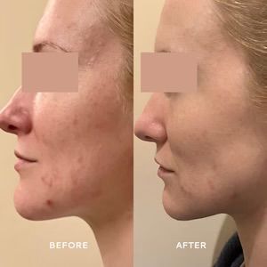 VOTARY Super Barrier Balm Cica and Probiotic